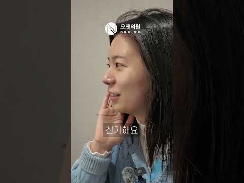 리프팅, 처지기 전에 예방하세요! 처짐 예방엔 티타늄 추천