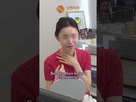 타병원 윤곽 3종 후 재수술, 에르메스급 변화: 명품급 결과 후기