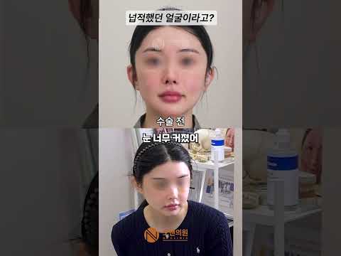납작했던 얼굴이 작고 예뻐진 비결은? 깎아도 넙적해 보이던 이유