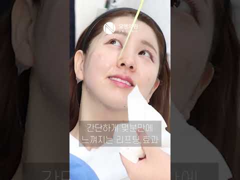 오앤 티타늄 리프팅으로 울퉁불퉁 얼굴 라인 개선: 라인 정리 후기