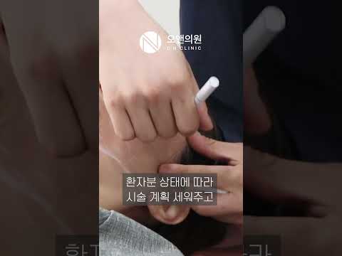 얇은 피부 실리프팅, 오앤의원에서 완벽하게: 티라미수 케익