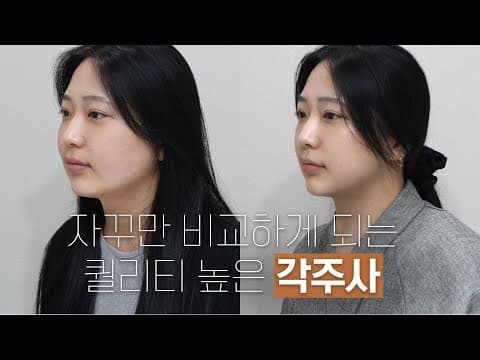 오앤 각주사 시술 효과: 퀄리티가 다른 각주사 전후사진 비교