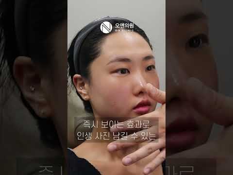 일본 고객도 찾는 연예인 리프팅 티타늄: K-BEAUTY의 정점