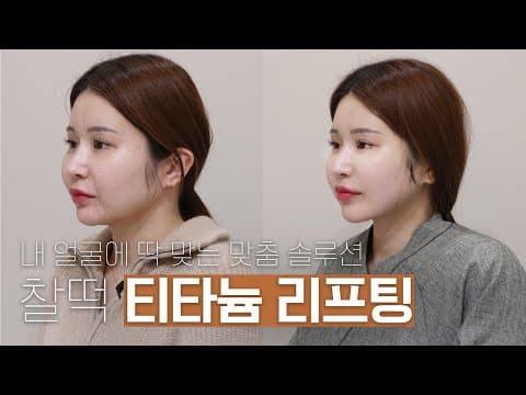 오앤 티타늄 리프팅: 내 얼굴에 맞는 찰떡 맞춤 솔루션 후기