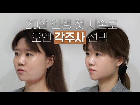 오앤 각주사 생애 첫 시술: 20살이 선택한 이중턱 솔루션