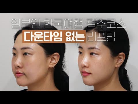 일본인 한국여행 필수코스, 다운타임 없는 티타늄 리프팅 [SBvDyq]