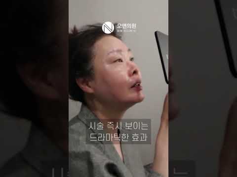 50대 피부 고민: 티타늄 리프팅으로 처짐과 주름 해결