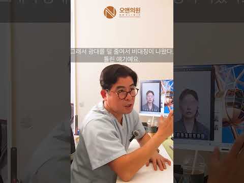 Zygoma reduction myths: midface reduction for a smaller face, bigger eyes