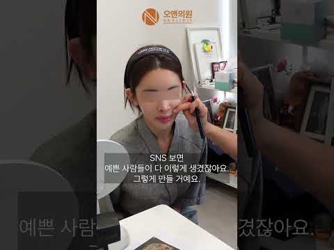 얇은 피부 안면윤곽 수술의 어려움과 결과: 예쁜 사람 더 어렵다