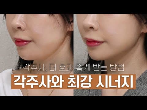 오앤 각주사 시술 후기 및 시너지 효과: 각주사 더욱 효과 좋게