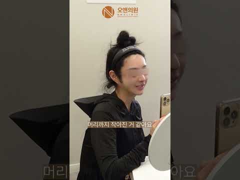 광대뼈 재수술: 계단 현상 개선 및 얼굴 축소, 연예인 드라마 사례