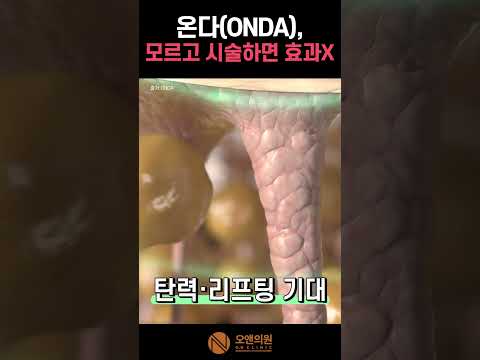 온다(ONDA), 모르고 시술하면 효과 없습니다 — 적합 대상과 효과 극대화