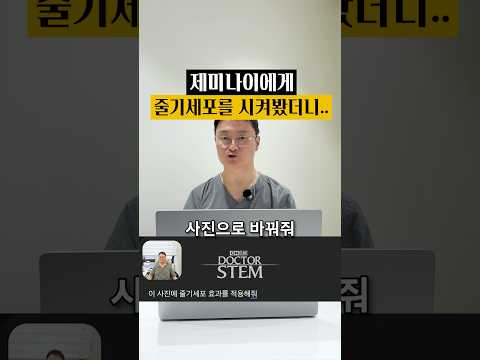 AI에게 줄기세포 시술 효과를 요청했더니: AI도 알아버린 위력