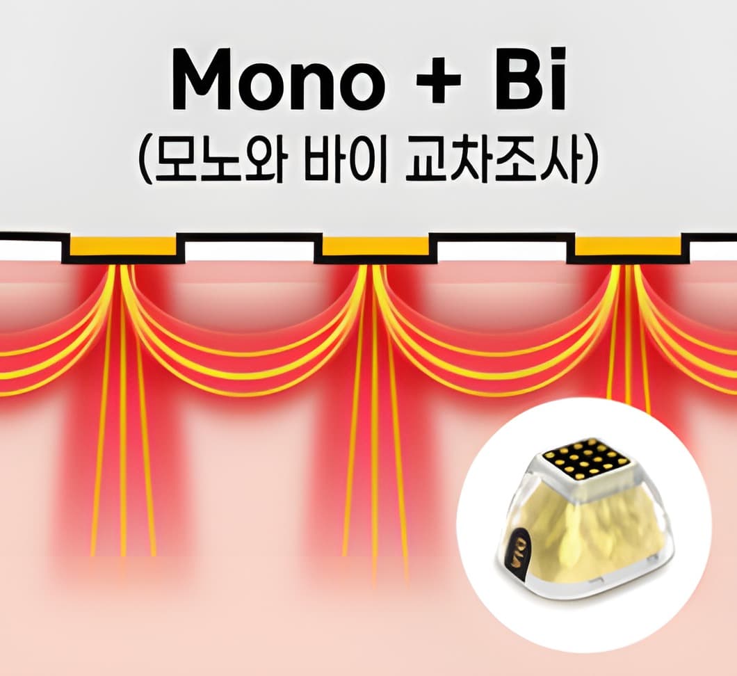 DIAMOND 모드