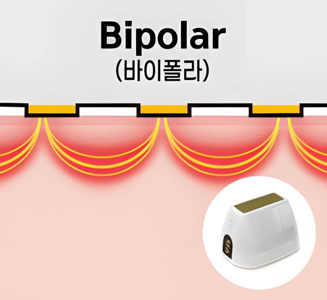 SFA 모드