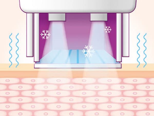 STEP 02: 진동 및 쿨링 시작