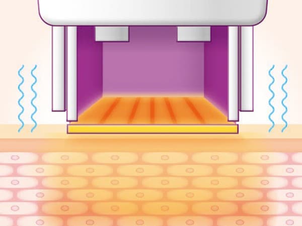 STEP 03: 고주파 에너지 침투