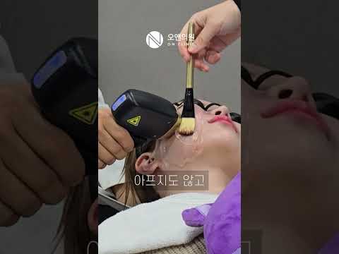 티타늄 리프팅 후기: 통증 없이 또 받고 싶은 즉각 효과
