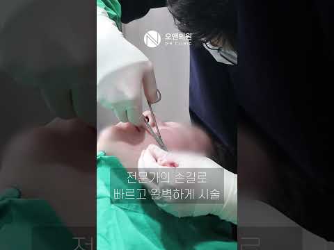 오앤의원 실리프팅: 팔자주름과 처짐 개선, 삐끼삐끼 치어리딩