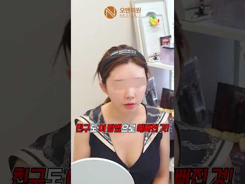 친구 추천으로 온 중안면 축소 후기: 친구 수술 결과 보고 결정