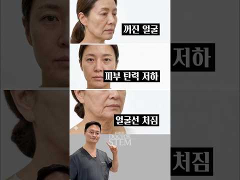 피부 노화 고민별 추천 시술: 이것만 알면 되는 6초 가이드