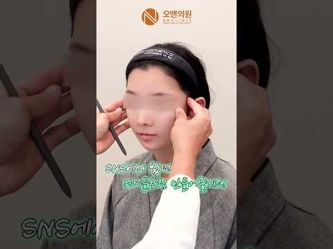 성형 시뮬레이션 후 깜짝 놀란 환자: 광대 시뮬로 초미녀 만들기